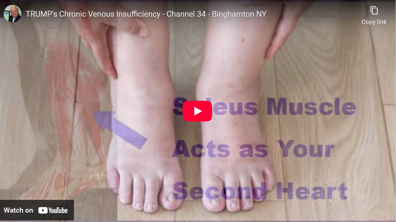 Load video: Watch our Video to help your blood circulation